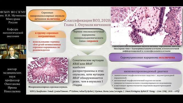 Опухоли женской репродуктивной системы: классификация ВОЗ-2020. Ovarian cancer. Cervical cancer. смотреть онлайн