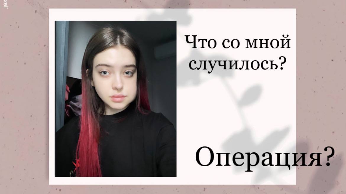 Что со мной случилось? ОПЕРАЦИЯ?