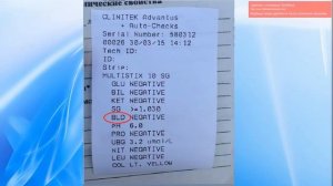 Общий анализ мочи часть 2 (ОАМ), клинический анализ мочи.