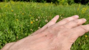 Жалит пчела / Укус пчелы процесс, последствия