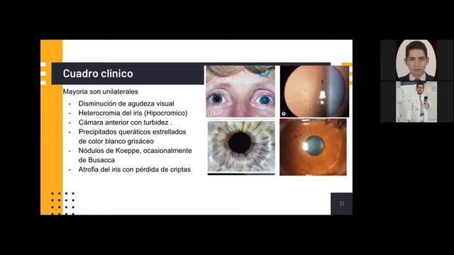 Clase Uveítis- Dra. García смотреть онлайн