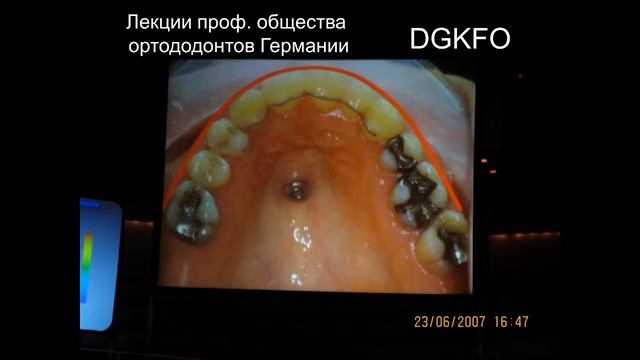 Организация ортодонтической помощи населению. смотреть онлайн