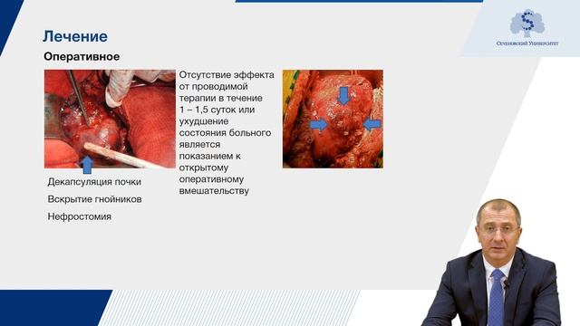 Пиелонефрит. Часть 2 смотреть онлайн