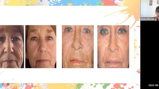 Masterclass Peelings Combinados. Yellow Peel y Peelmoist смотреть онлайн