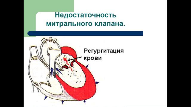 11:30-13:00 Основные симптомы и синдромы, выявляемые при клинико инструментальном обследовании боль смотреть онлайн