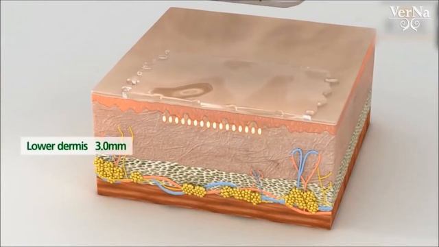 УЛЬТРАФОРМЕР