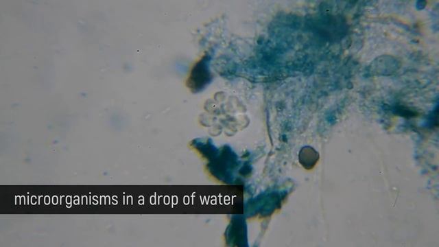 Microorganisms In A Drop Of Water Under The MICROSCOPE // Invisible World