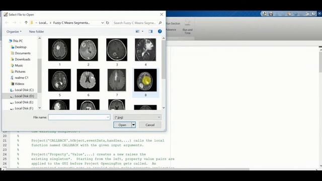 Image Segmentation Using Fuzzy C Means Clustering Matlab Source Code смотреть онлайн
