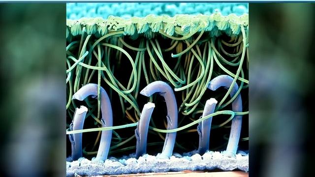 Угадай Что на Фото (99% Ошибаются) смотреть онлайн