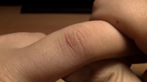 Отличное средство для заживления ран