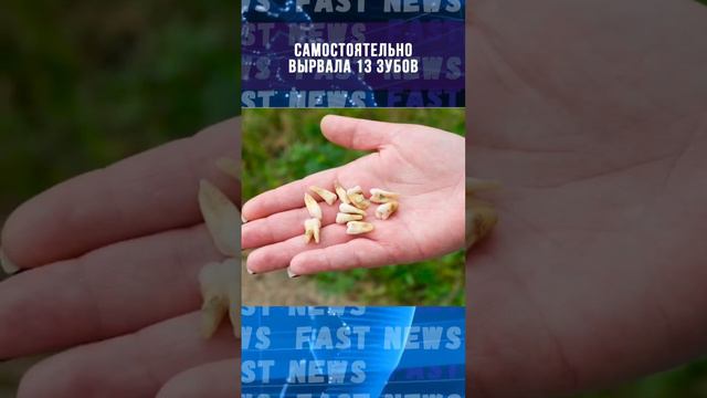 #british #freak Вырвала себе 14 зубов смотреть онлайн