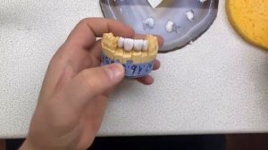 Нанесение керамики emax на каркас из диоксида циркония. Керамика.