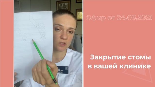 Закрытие стомы в вашей клинике смотреть онлайн