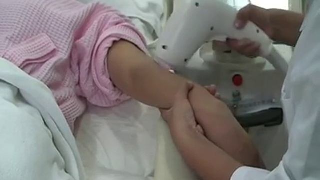 Лазерная эпиляция.  Диодный лазер HONKON 808AL