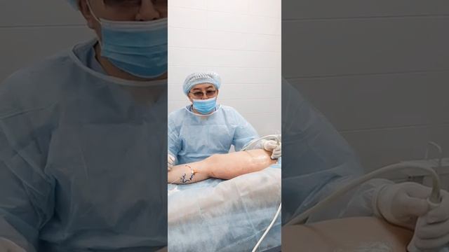 Процедура ЭВЛК, комбинированная с мини-флебэктомией и склеротерапией (Нина) смотреть онлайн