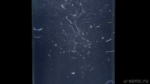 Ультразвуковая кавитация. УЗ аппарат "Волна" смотреть онлайн