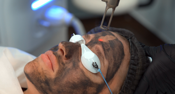 Карбоновый пилинг c главным врачом клиники МариЛав