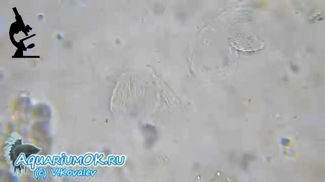 Деление инфузории хилодонеллы (Chilodonella piscicola) смотреть онлайн