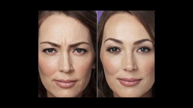 #истинная причина морщин смотреть онлайн