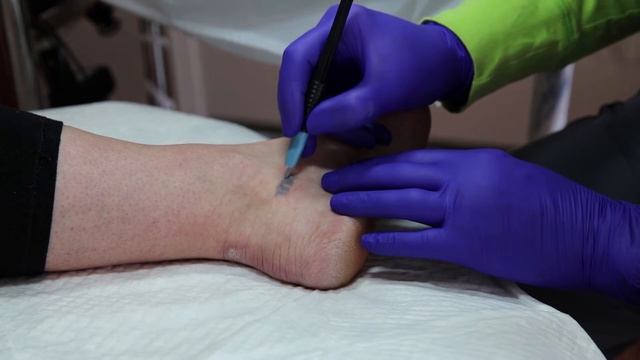 CRC Tattoo Remover смотреть онлайн