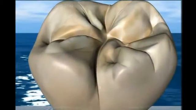 Снятие зубного налета смотреть онлайн