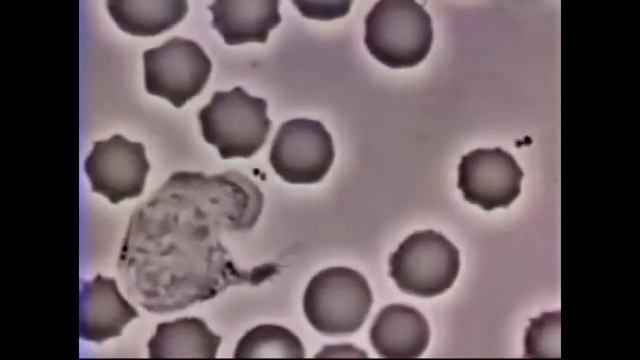 White Blood Cell Chases Bacteria, but I put The World Revolving over it смотреть онлайн