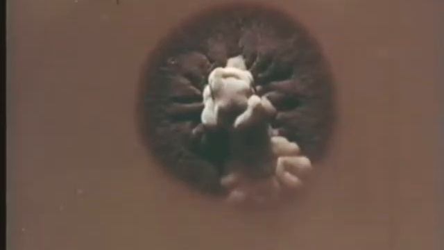 (R) Дерматомикозы © Dermatomycosis