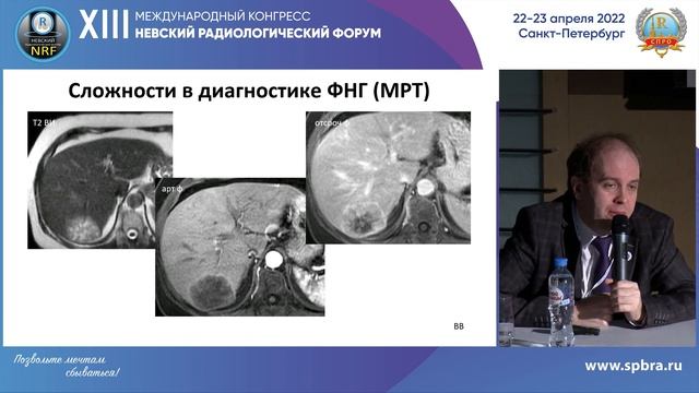КОМПЛЕКСНЫЙ ПОДХОД К ЛУЧЕВОЙ ДИАГНОСТИКЕ ЗАБОЛЕВАНИЙ ПЕЧЕНИ. АНАЛИЗ ОШИБОК смотреть онлайн