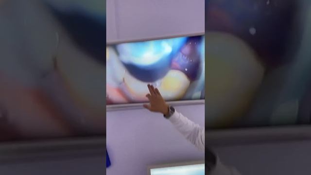 Невидимый кариес такое возможно ? Кариес между зубами , контактный кариес . Лечение зубов , пломба