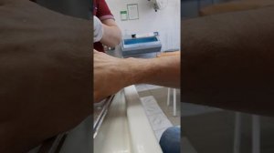 4я перевязка перелома мизинца (17.04.21)