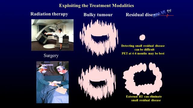 Some currents concepts in Gynecological Cancer - Neville F. Hacker, M.D. смотреть онлайн