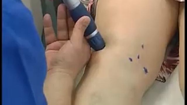 Клиника ХОСАДО   Каменск Уральский биомеханическая стимуляция