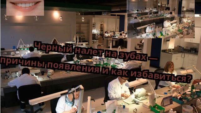 Черный налет на зубах — причины появления и как избавиться? смотреть онлайн