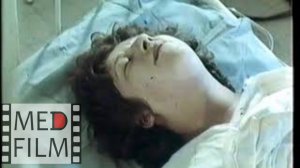 Роды при чистом ягодичном предлежании, проф. Ванина Л.В. © Breech presentation