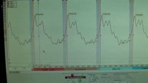 Датчик разряжения