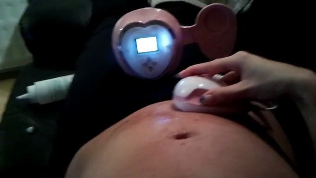 Angelsounds doppler JPD-100S4 - Mi Corazon смотреть онлайн