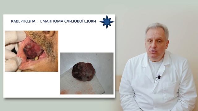 Передракові захворювання губи та слизової порожнини рота смотреть онлайн