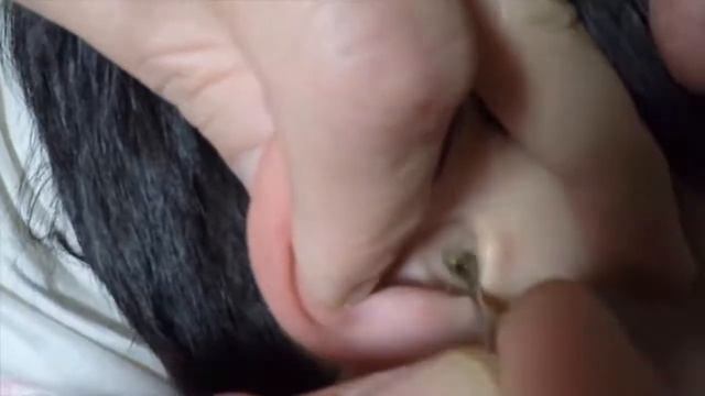 Выдавливаем прыщи. Чистка ушей #1