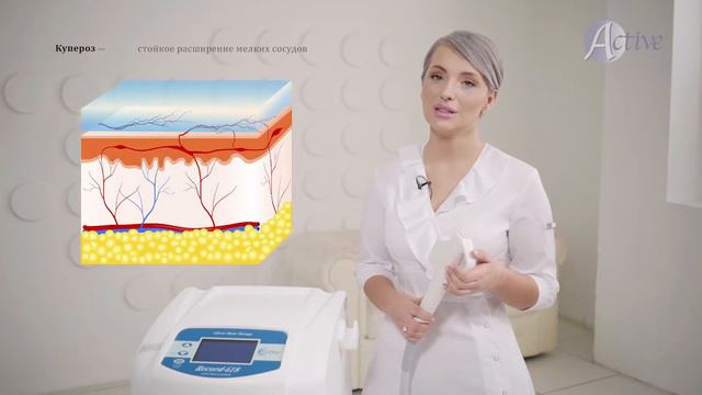 Удаление купероза. Что такое купероз, ответ эксперта Кристины Филатовой смотреть онлайн