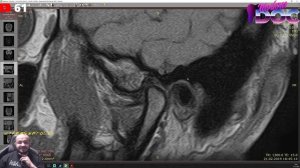 МРТ ВНЧС УЧИМСЯ ЧИТАТЬ