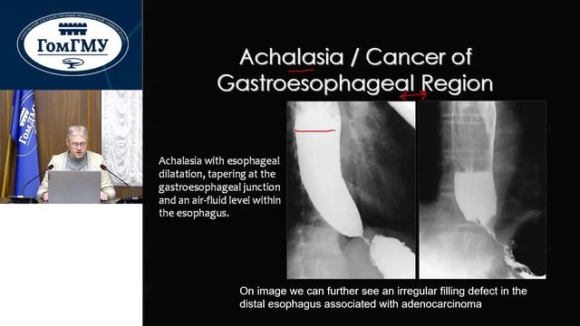Nicolay M. Yermalitsky. Basic Diagnostic Radiology. Gastrointestinal Tract