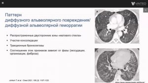 Лекарственно-индуцированные поражения легких