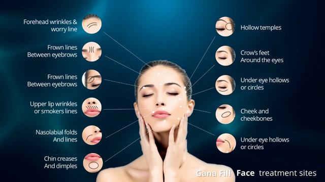 [GANA FILL] GANA FILL Video