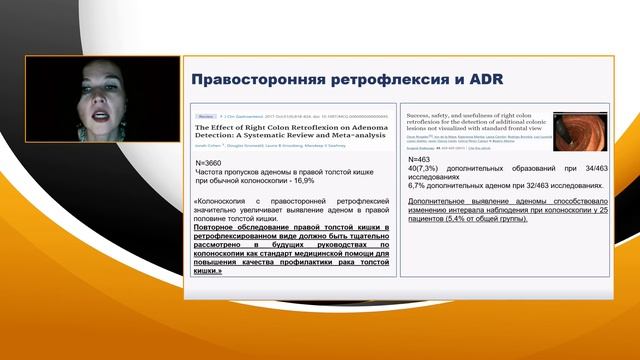 4 Агейкина Параметры эффективности выявления правосторонних эпителиальных образований толстой кишк смотреть онлайн