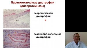 Патологическая анатомия 1.Введение.Дистрофии