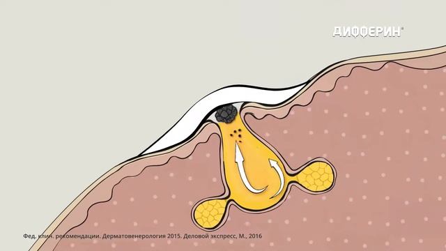 AVANT | Дифферин | Отдых | рекламная кампания «Страхи» смотреть онлайн