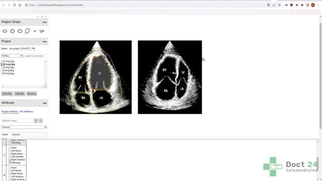 Разметка изображений с помощью VGG Image Annotator (VIA) смотреть онлайн