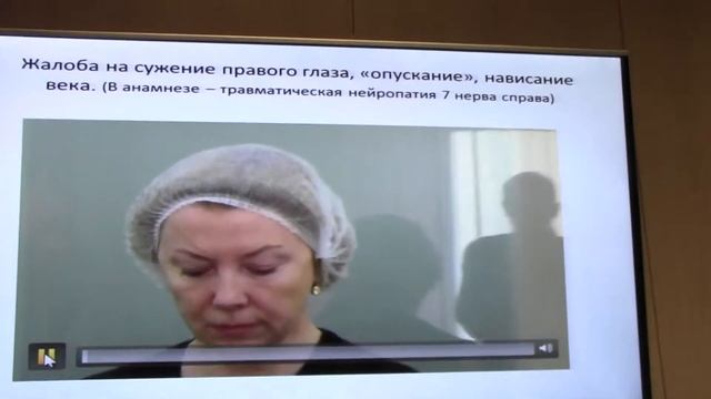 нейроваскулярный конфликт 3