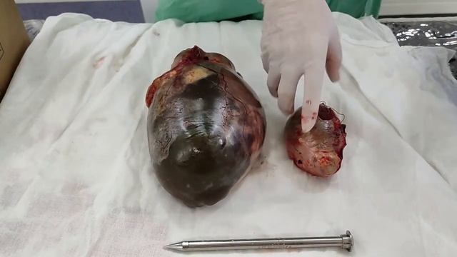 Киста яичника. Определение, виды. смотреть онлайн