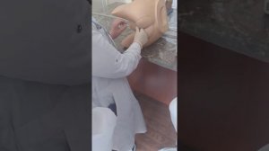 пальцевое исследования прямой кишки
